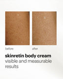 Mesoestetic Skinretin Body Cream