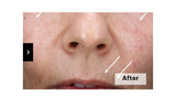 Skinretin Xpert With Exosomes