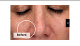 Skinretin Xpert With Exosomes