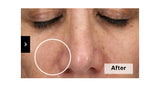 Skinretin Xpert With Exosomes